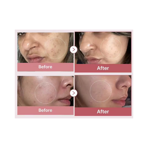 Sérum peptides de collagène